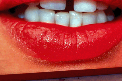 Dylan Don Lightbox JJ'S LIPS 